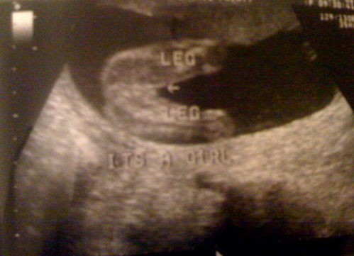 ultrasound11.jpg